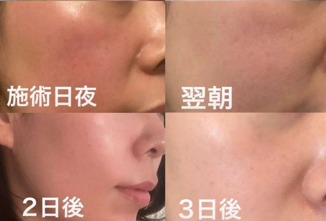 エステ UN・MULAN (大田　瑶子)のマツエク・マツパデザイン