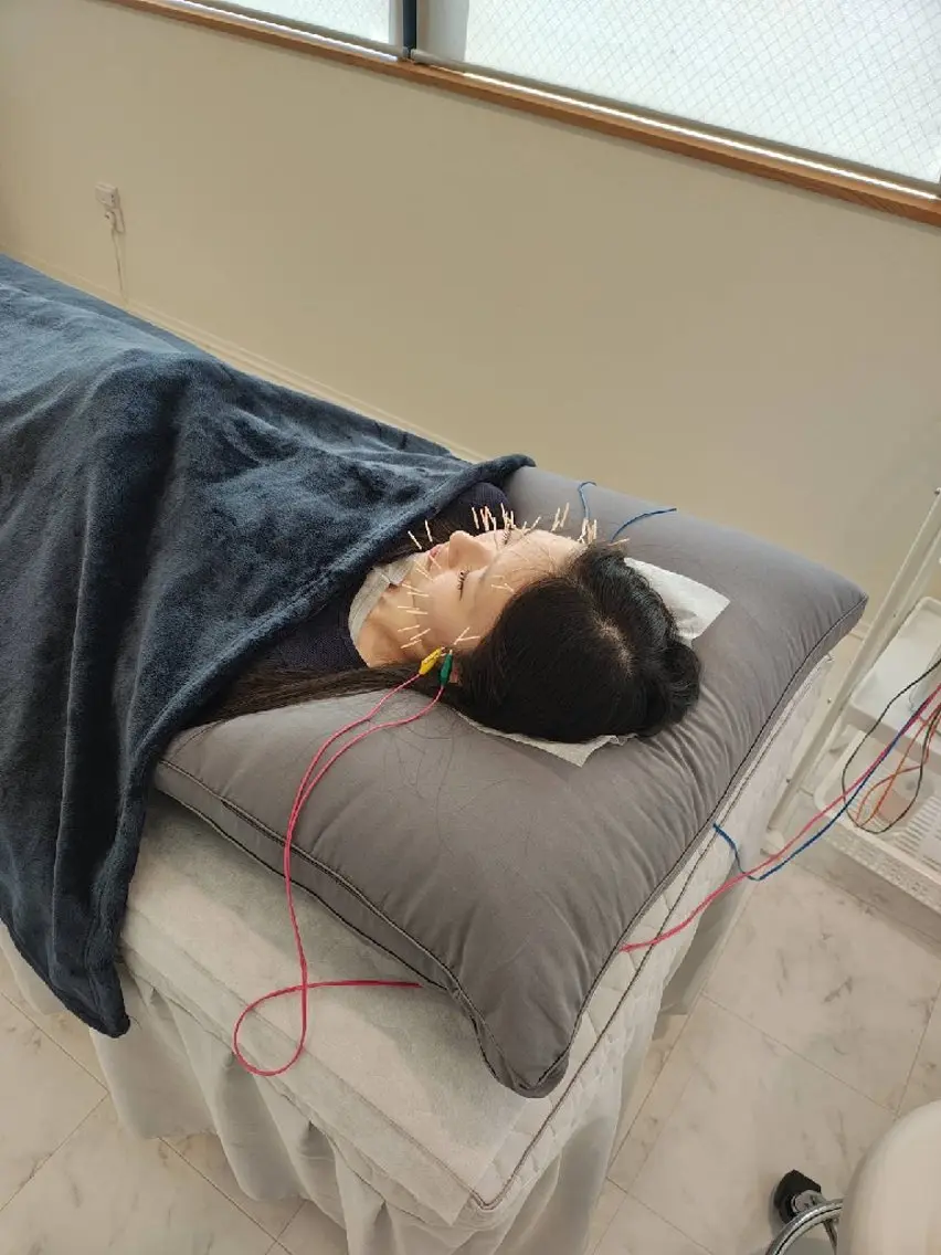 【学生様限定特別価格✨️】Premium美容鍼コース✕選べる1手技✕韓国式LED美顔器 80分 #肌質改善の写真