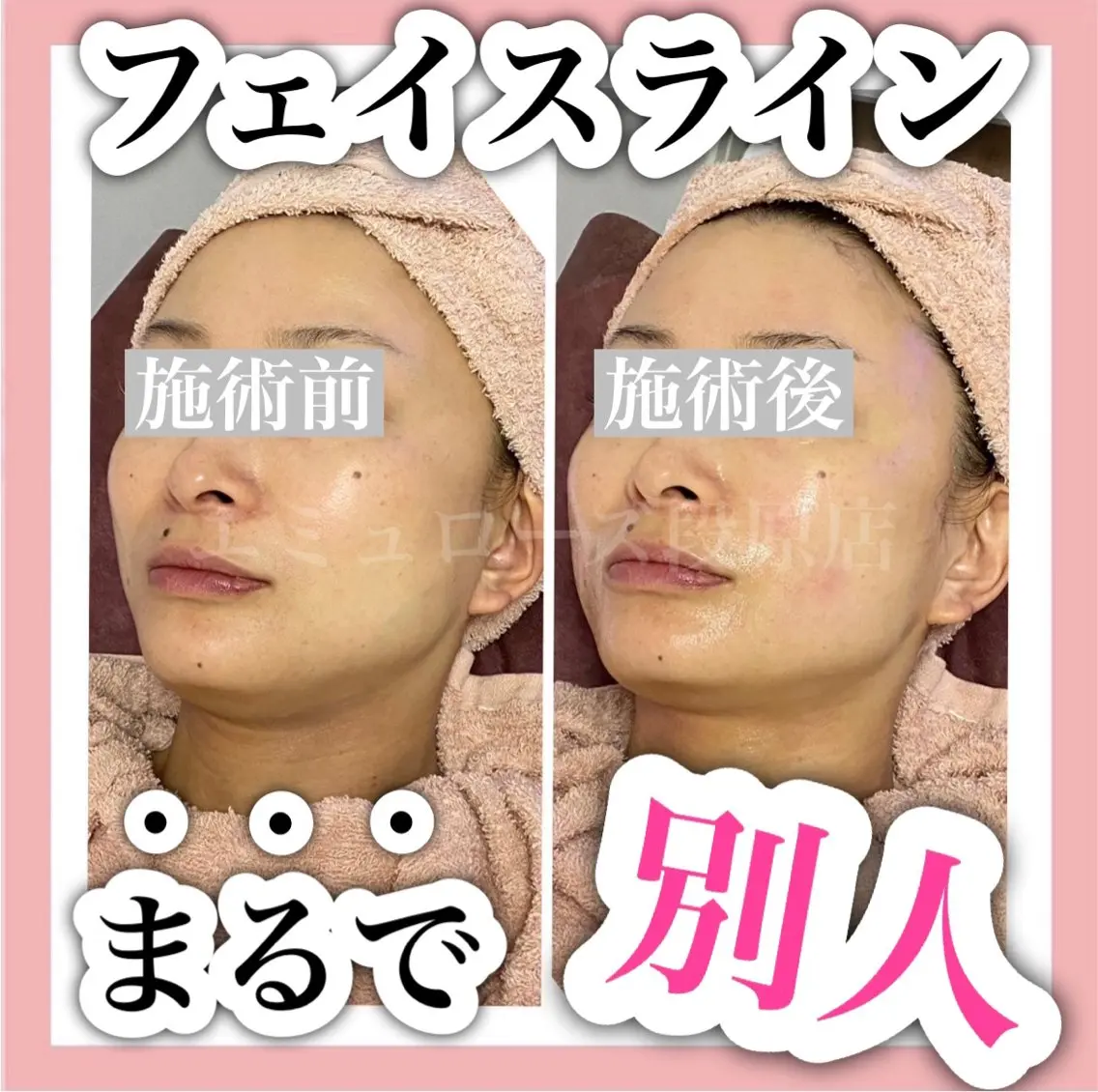 エステ リラク Nm'Rose 段原店のマツエク・マツパデザイン