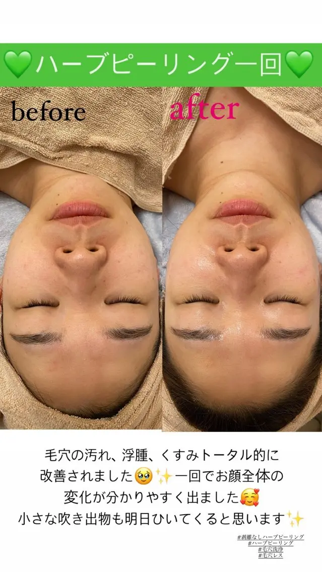 エステ Salon de Lino 御器所のエステ・リラクイメージ