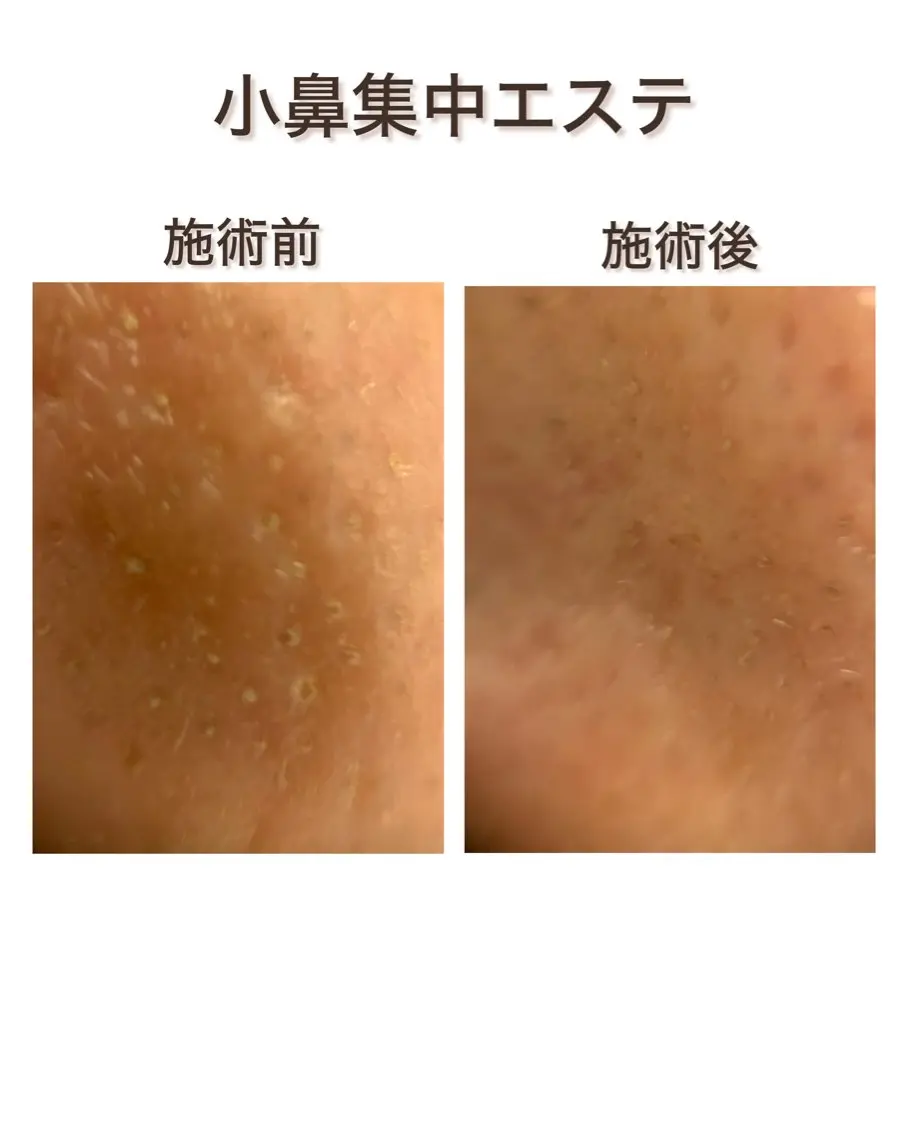 碇(安原) 菜々子のエステ・リラクイメージ
