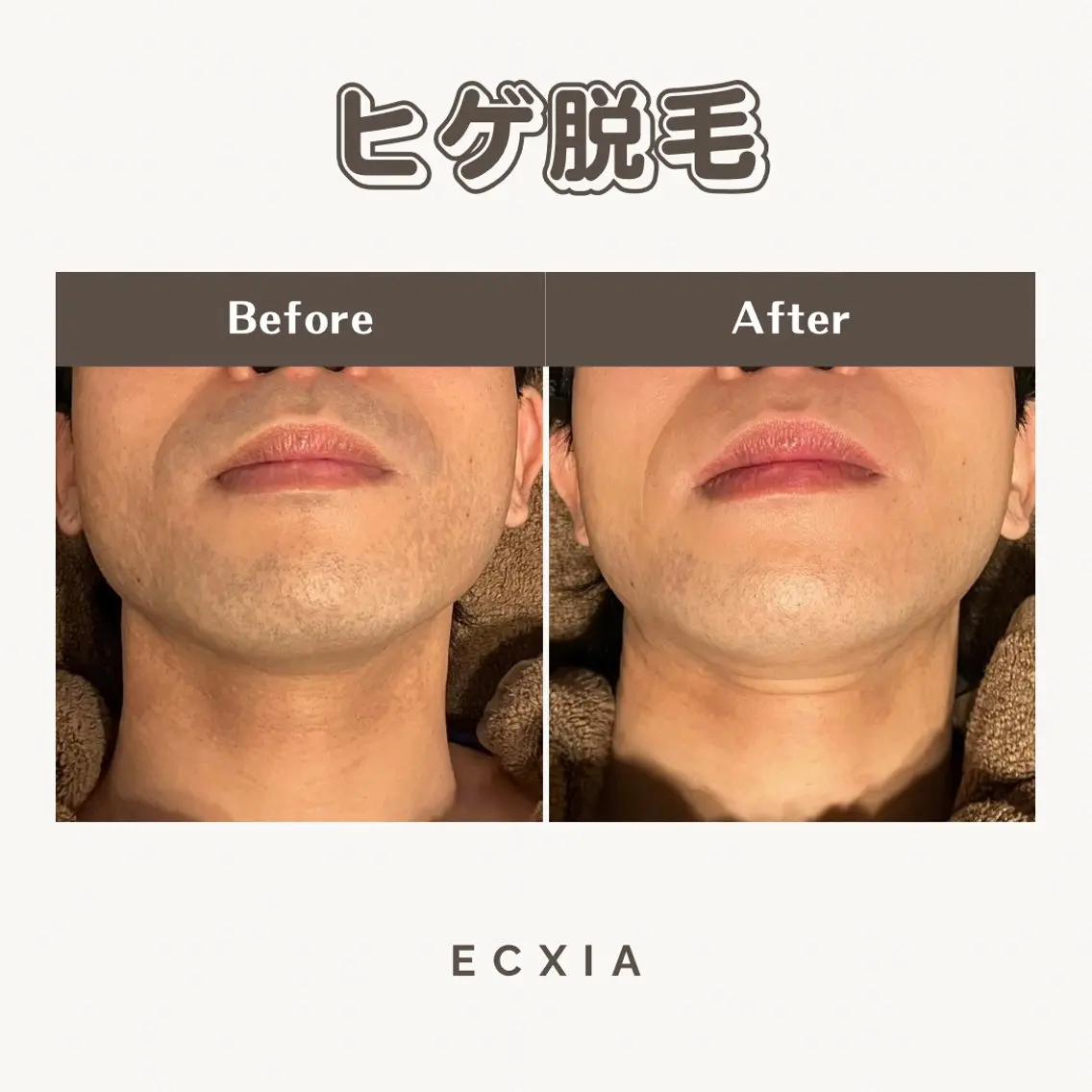 メンズ メンズ脱毛サロン ECXIA 博多のエステ・リラクイメージ