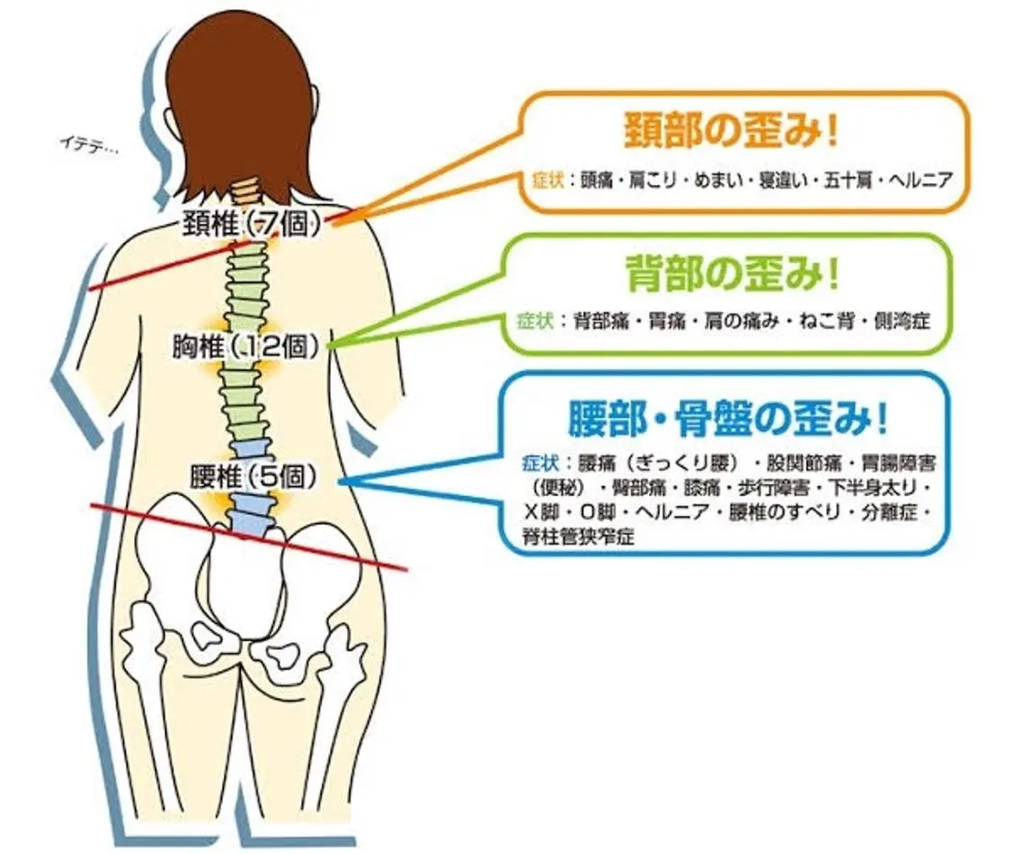 背骨、骨盤矯正1ヶ月受け放題の写真