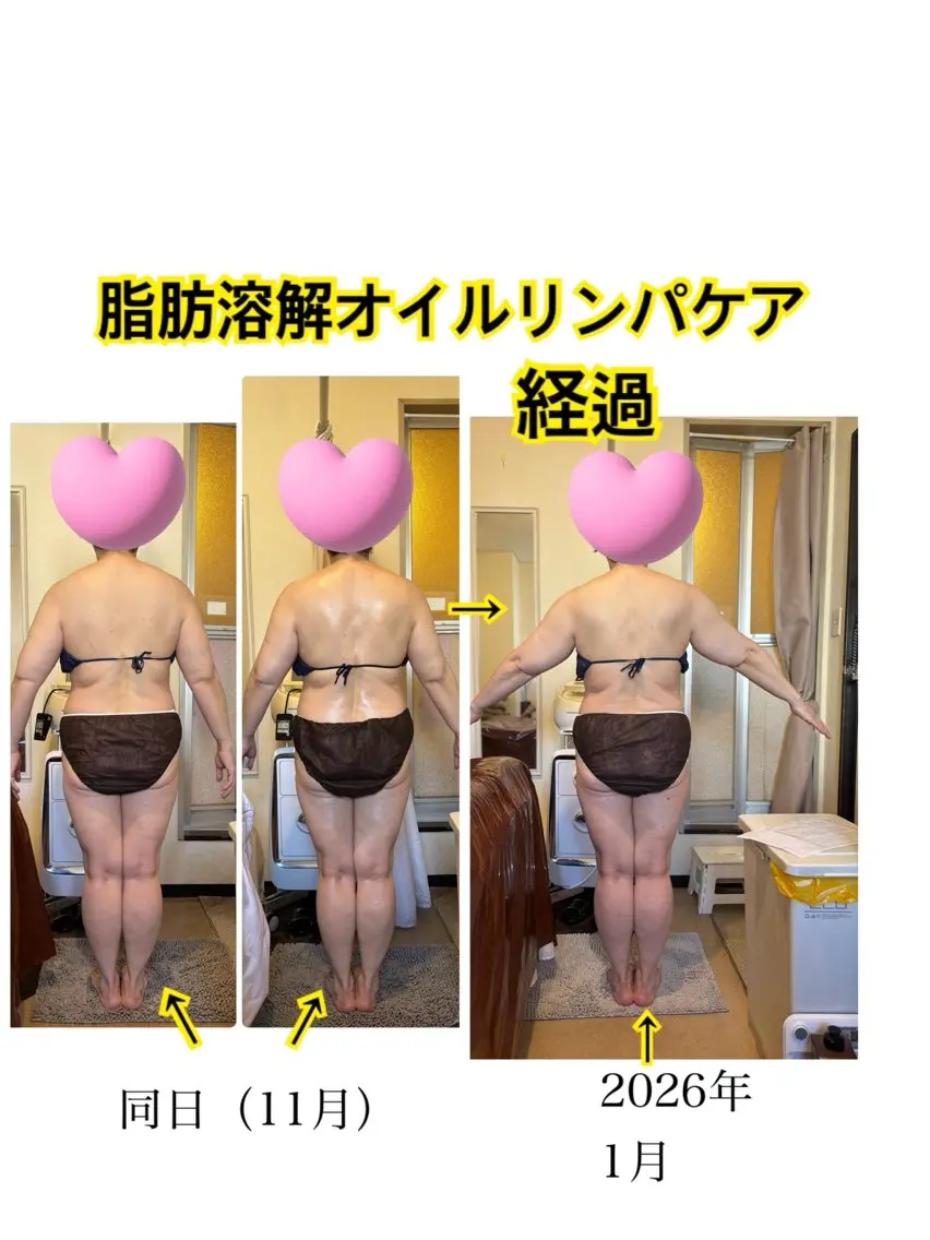 エステ 西田 美恵子のエステ・リラクイメージ