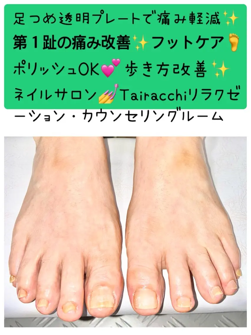 ネイル フットネイル Tairacchi タイラッチのエステ・リラクイメージ