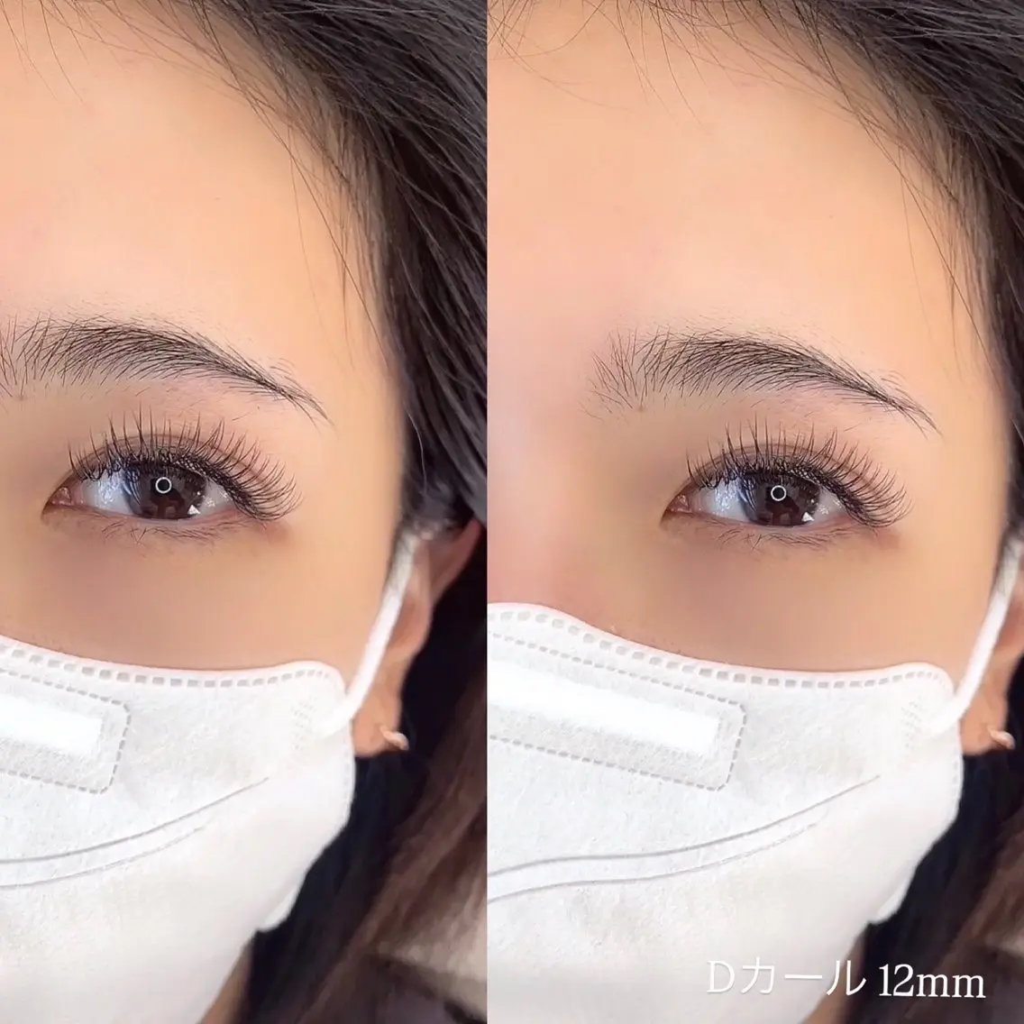 フラットラッシュ160本の写真
