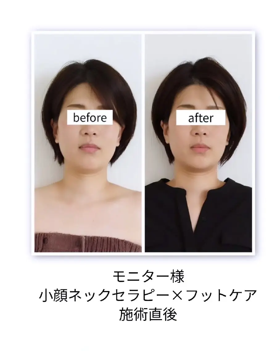 桜井市｜小顔矯正・ 姿勢改善 madoiのエステ・リラクイメージ