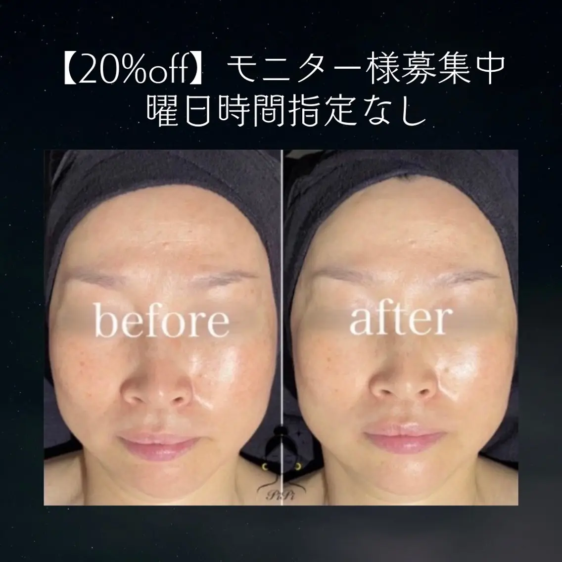 集まり次第終了 |モニター様募集| 20%off |時間曜日指定なし🌙小顔リンパマッサージの写真