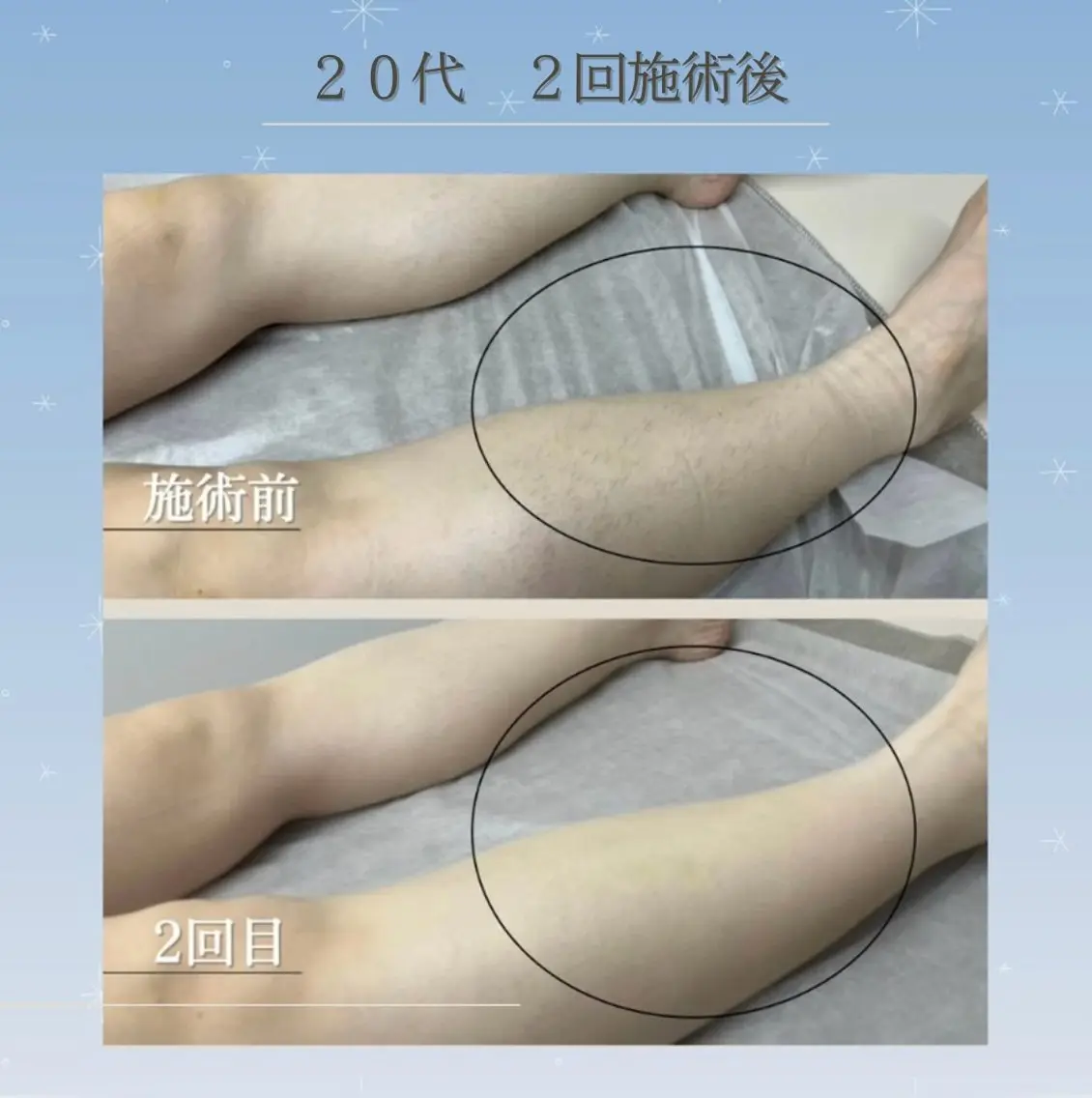 LED脱毛サロン 💐ayaのエステ・リラクイメージ