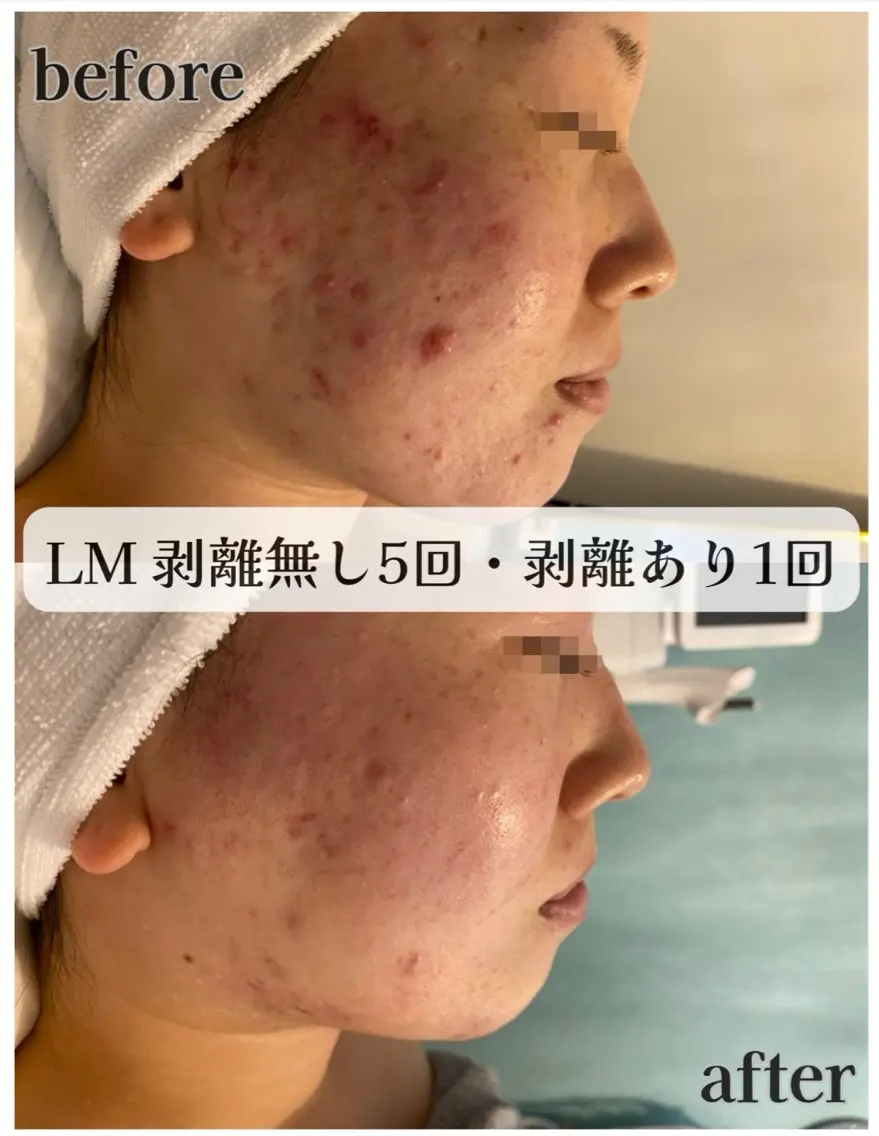 LIME 武庫之荘のエステ・リラクイメージ