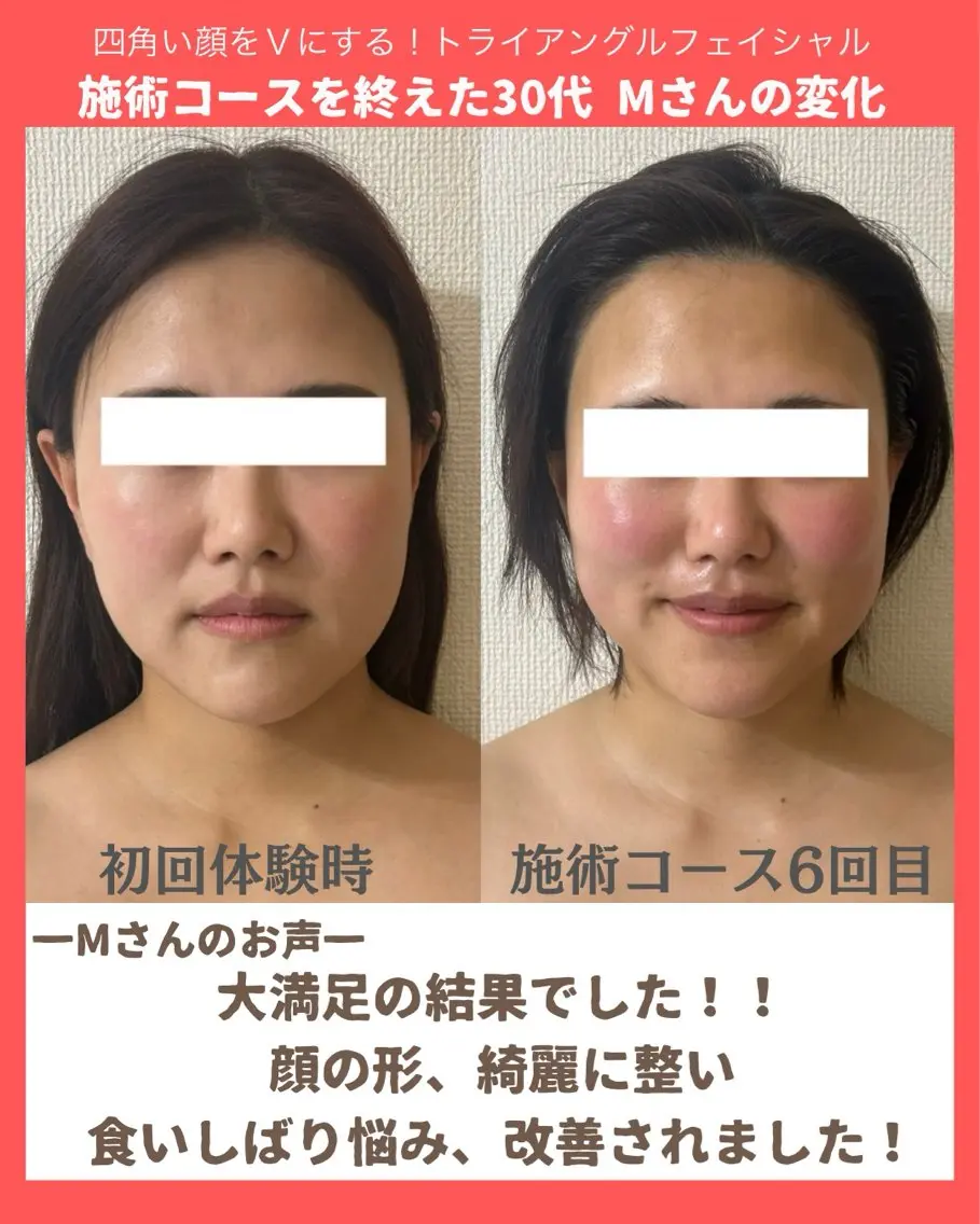 小顔サロン (ラ リュミエール)のエステ・リラクイメージ