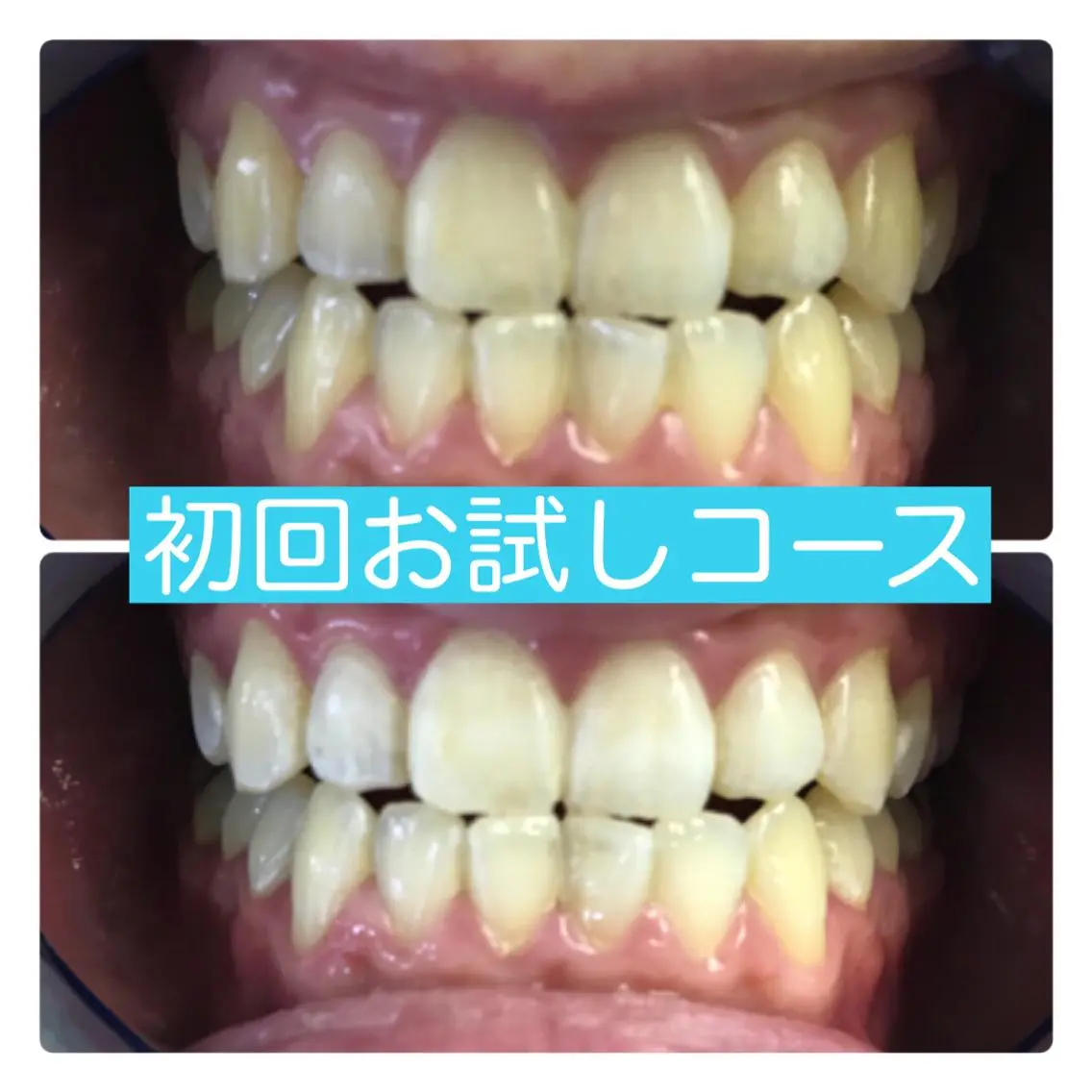 ホワイトニングルーム 横浜店のその他イメージ