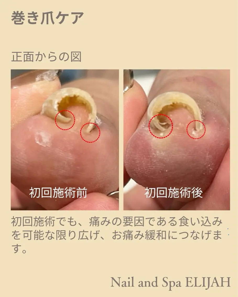 ネイル フットネイル ダンラップ新里 友簣乃のネイルデザイン