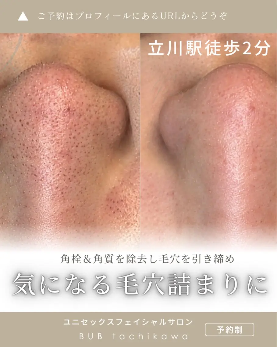 メンズ エステ 【BUB立川】 ゆかのエステ・リラクイメージ