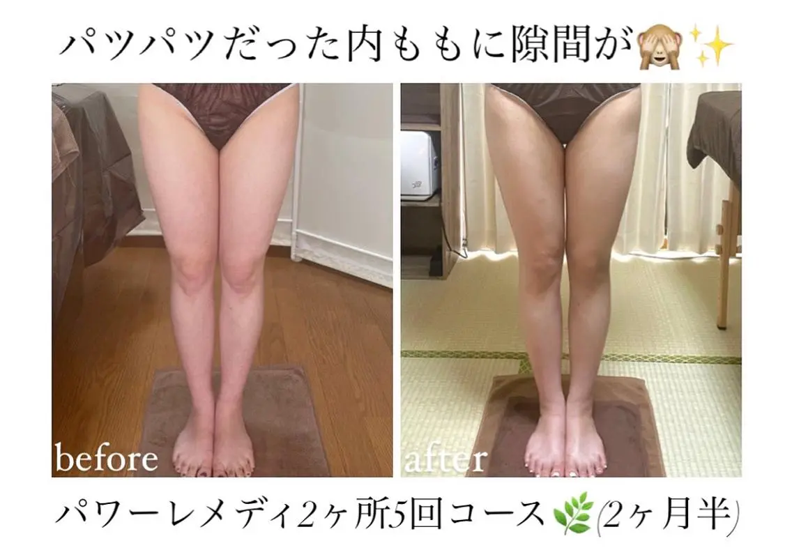 《本気痩せ×疲労改善 》 BILOOPのエステ・リラクイメージ