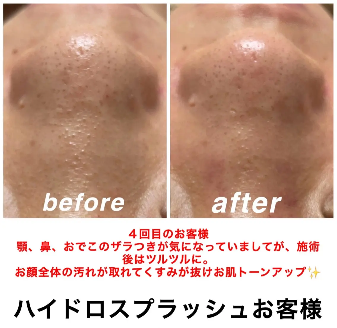 エステ リラク ネイル・エステサロン UILANIのエステ・リラクイメージ