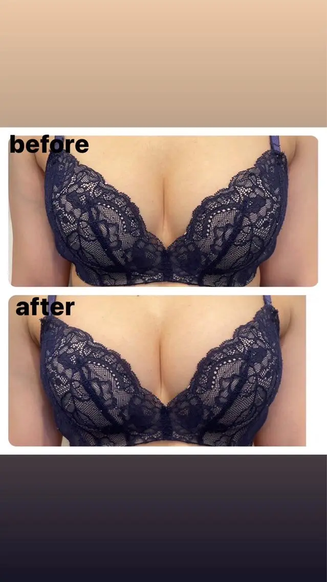 口コミ&モニター限定価格💕【20代】モテバストアップ痩身👙の写真