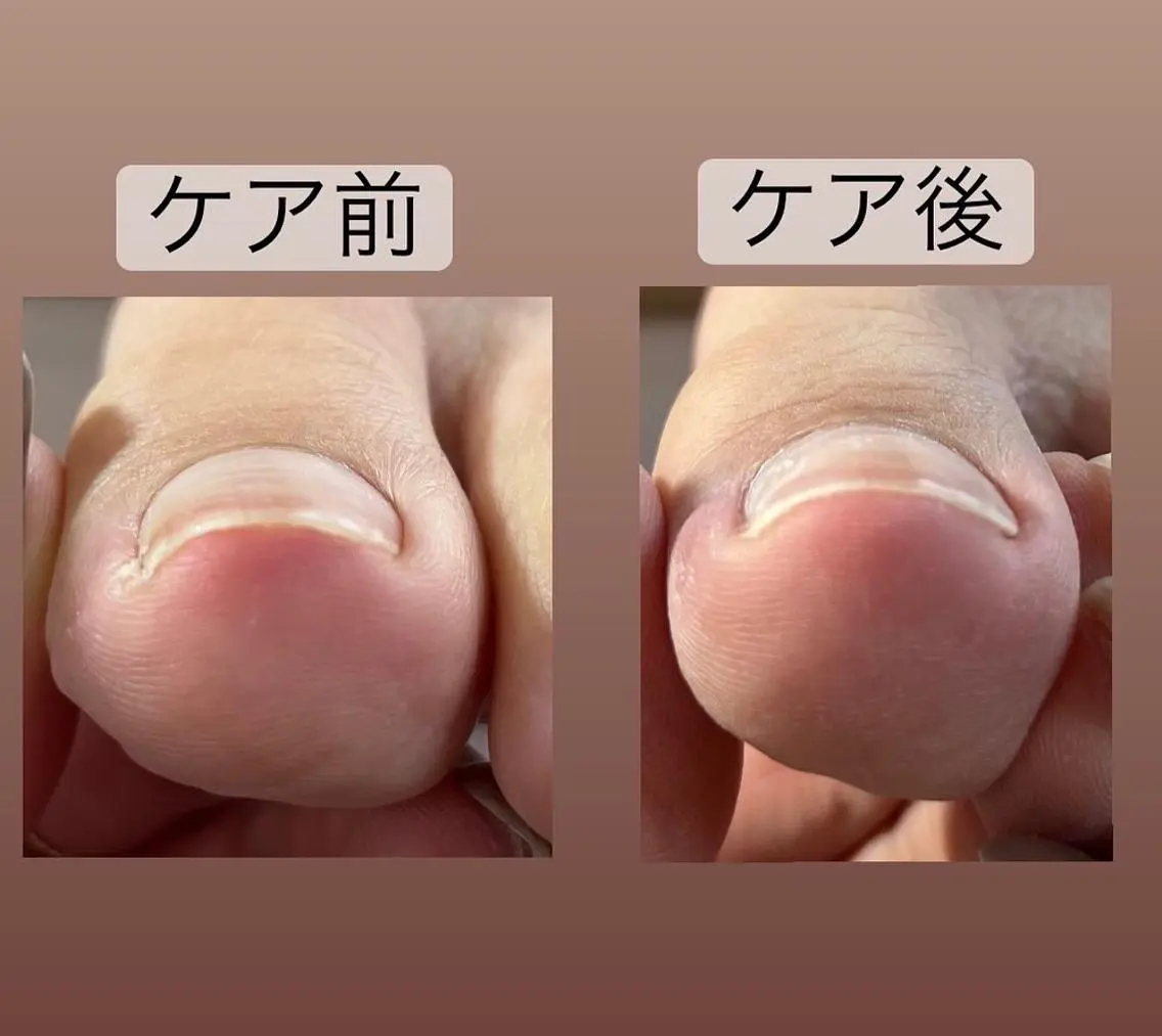 その他 藤山 香奈のネイルデザイン