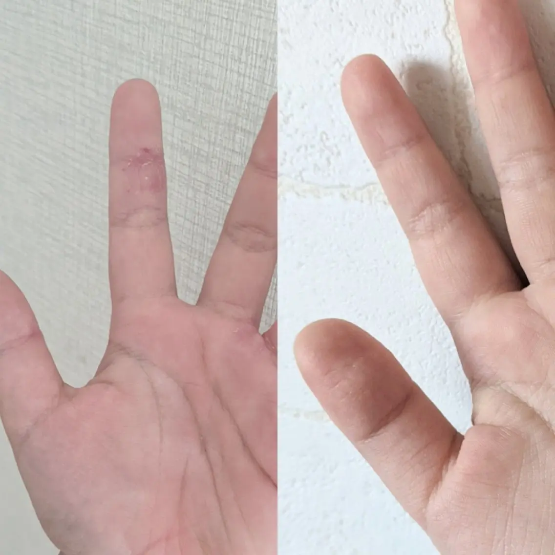 結果が出るスキンケア 肌質改善/まつパのエステ・リラクイメージ