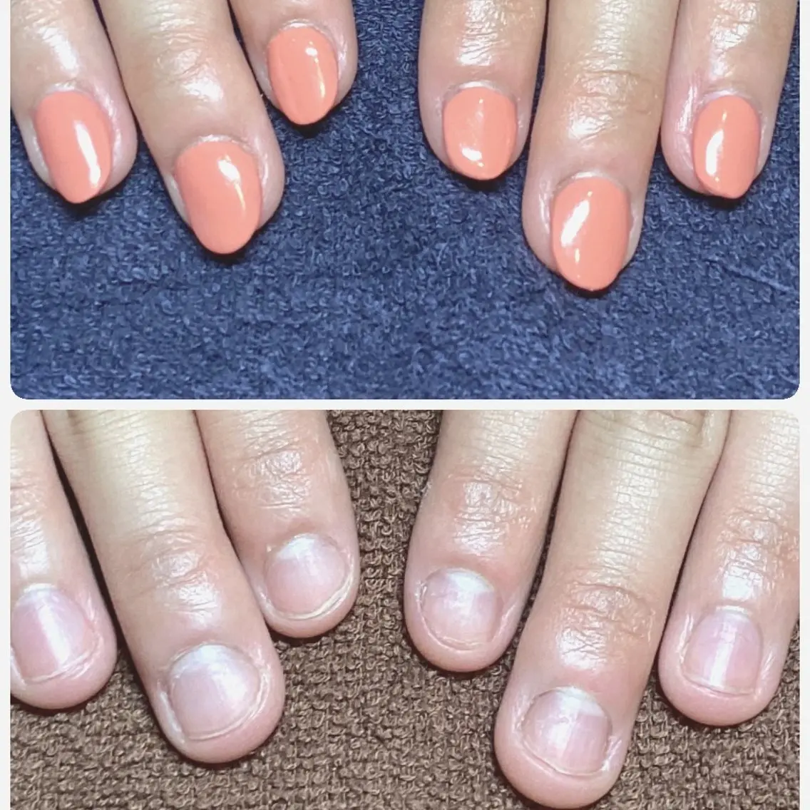 ネイル 長さ出し ハンドネイル ハンドケア 深爪矯正/爪育成ケア manie nailのネイルデザイン