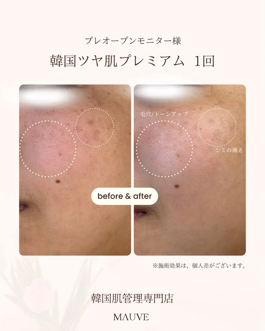 エステ MAUVE minamiのエステ・リラクイメージ