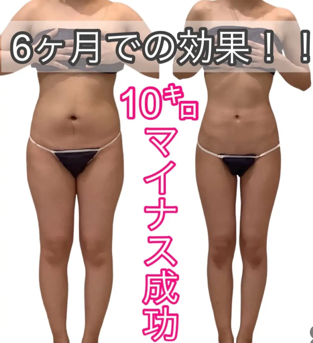 痩身ダイエット&小顔 🩷アールズスリムのエステ・リラクイメージ