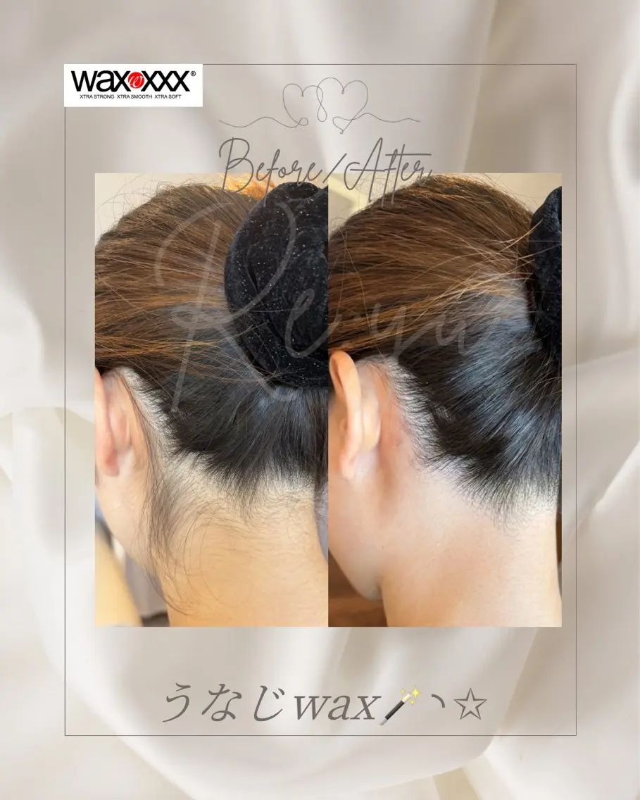 脱毛 Re:yu┃wax 脱毛┃糸島市のエステ・リラクイメージ