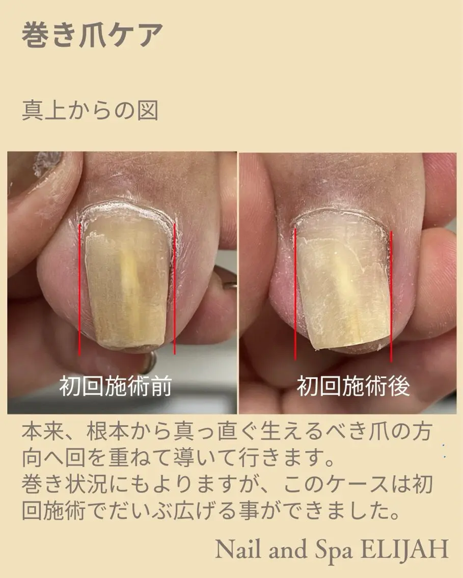 ネイル フットネイル ダンラップ新里 友簣乃のネイルデザイン