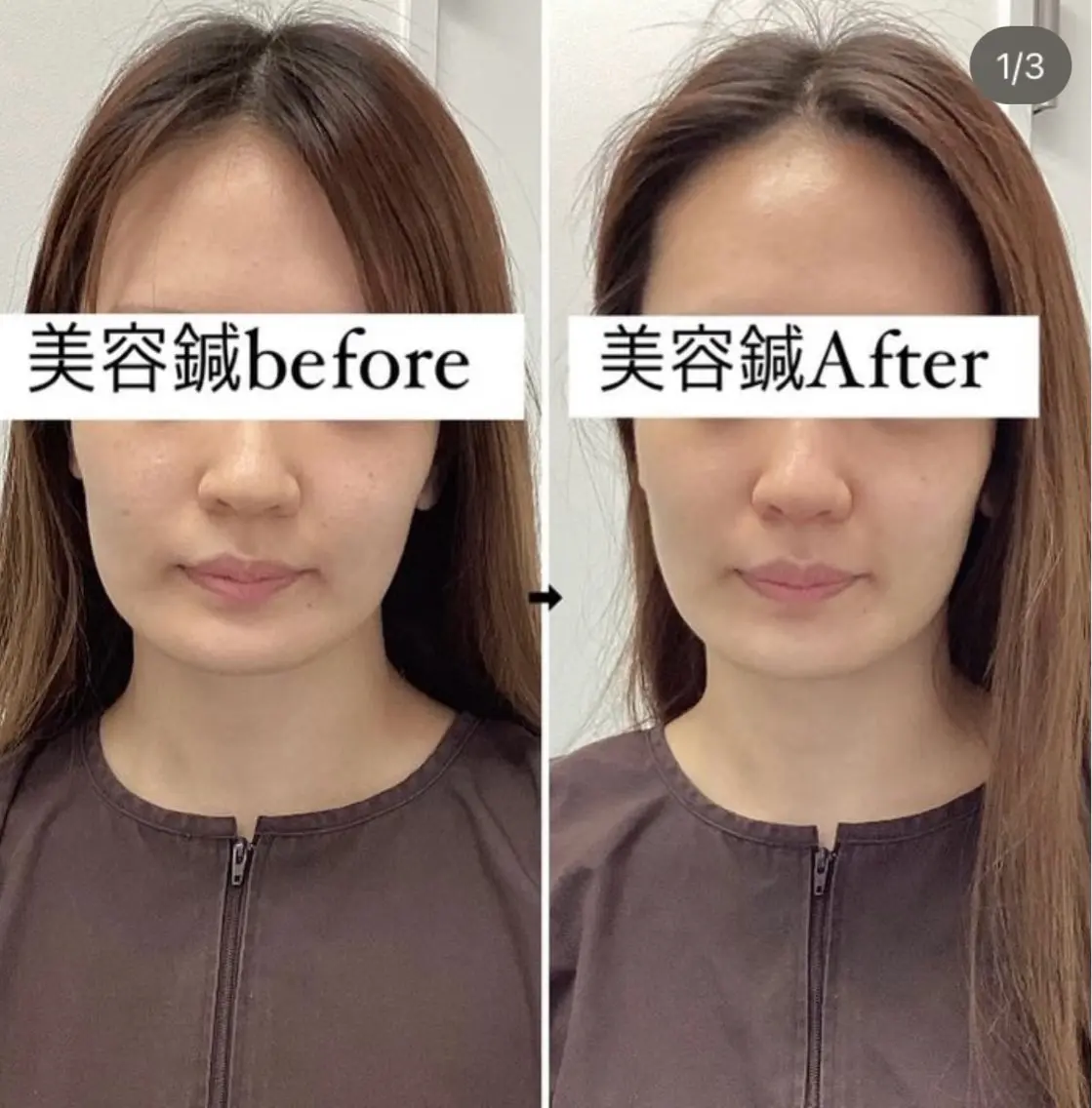 エステ リラク 美容鍼灸×小顔整体♡ ハリサロンドオフ堺東のその他イメージ