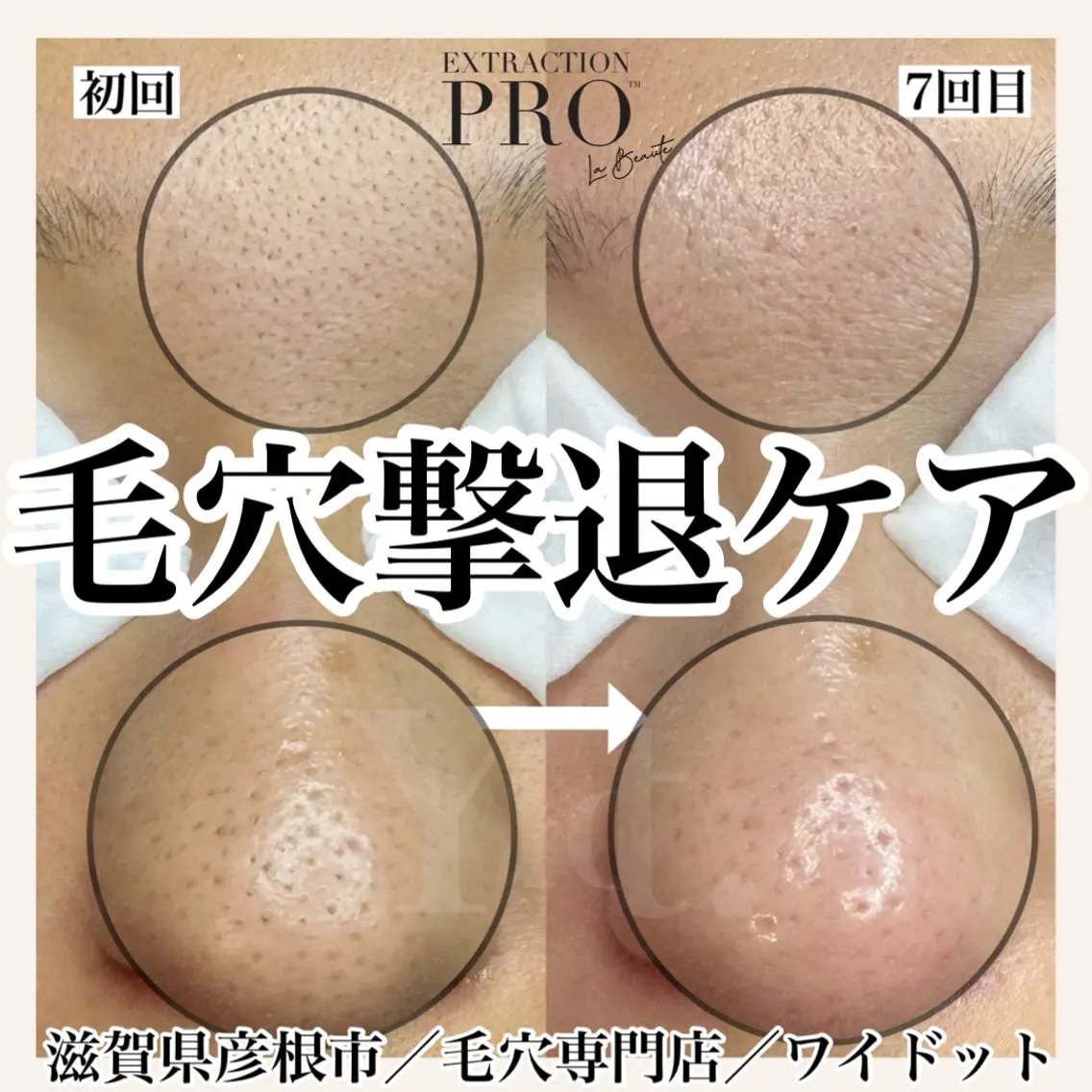 エステ Ydot. 池内 友架のエステ・リラクイメージ