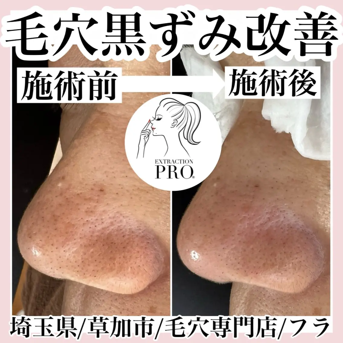 エステ 毛穴専門店hula 杉山智美のエステ・リラクイメージ