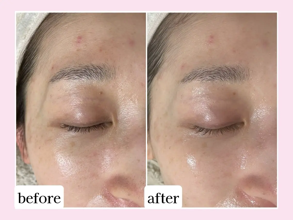 💜Karen PrivateSpaのエステ・リラクイメージ
