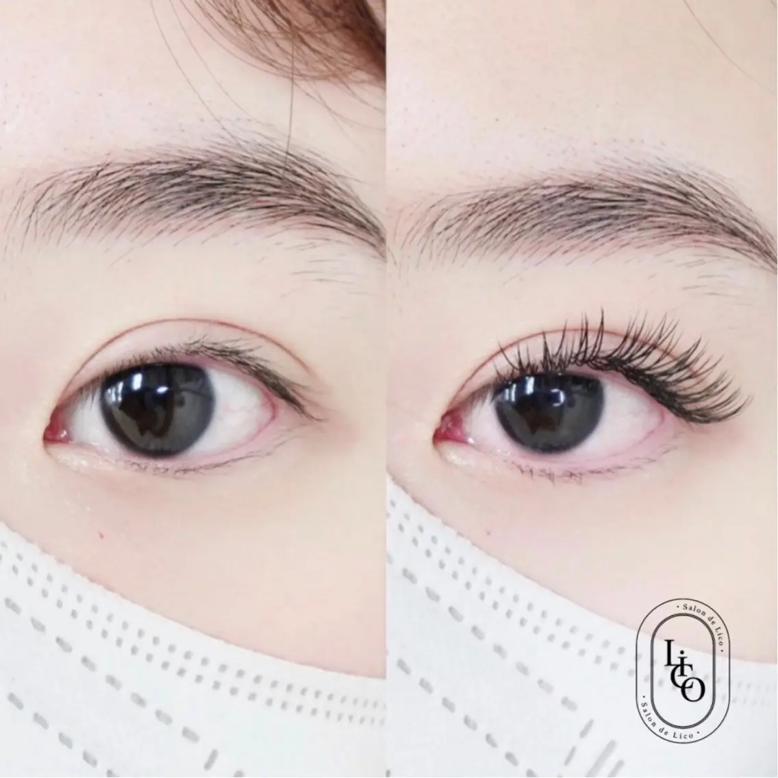 フラットラッシュ140本の写真