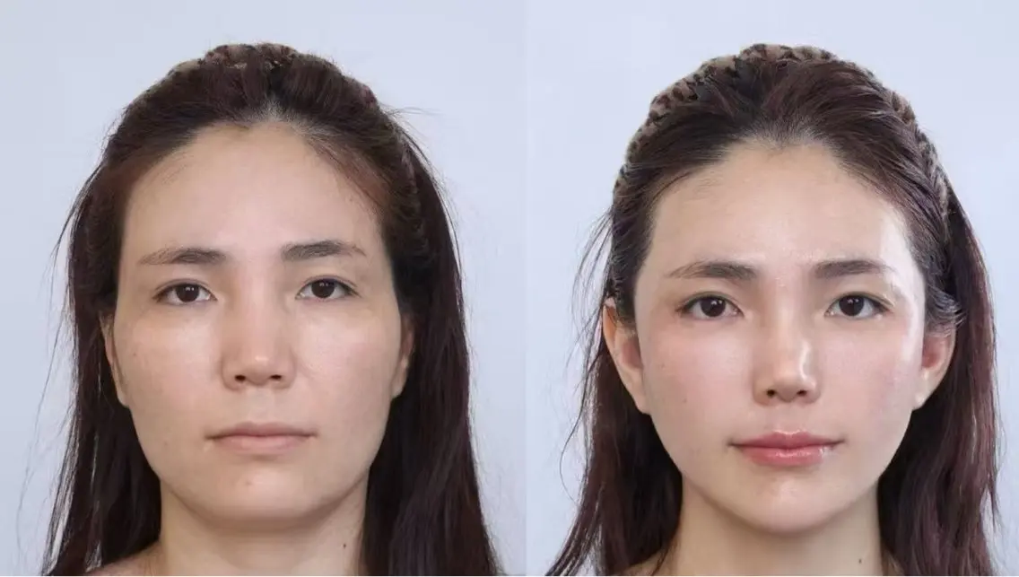ネイル 愛維美水光専門店 川崎彩鳳のエステ・リラクイメージ
