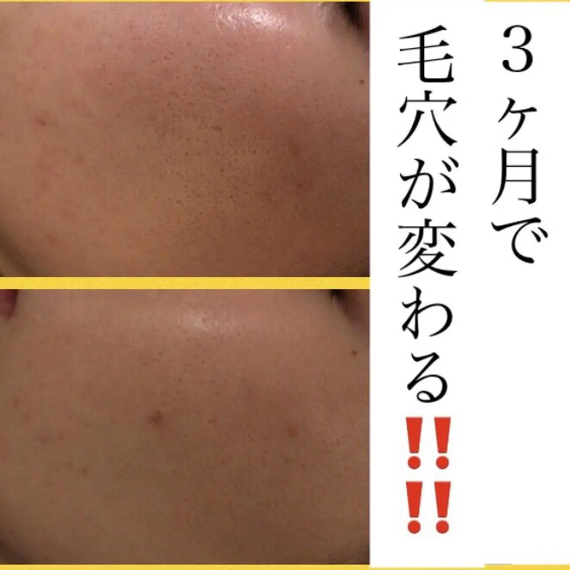 ミディアム カラー パーマ ヘアアレンジ メンズ キッズ マツエク・マツパ エステ リラク ニキビ・肌質改善専門 ♡人生が変わるサロンのエステ・リラクイメージ