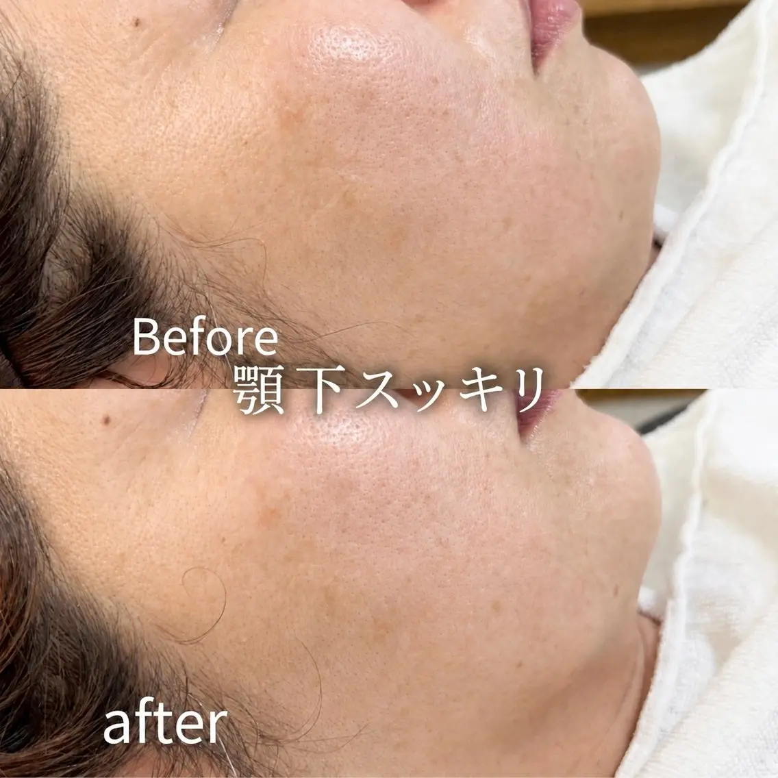 エステ Balance facialのエステ・リラクイメージ