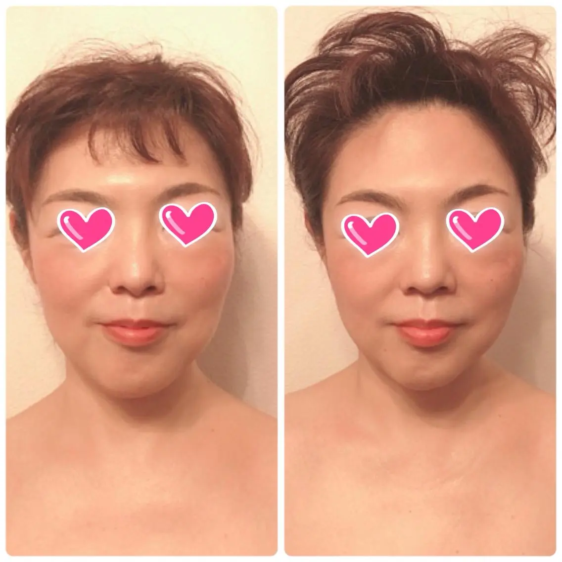 調律エステ /美KISSのその他イメージ