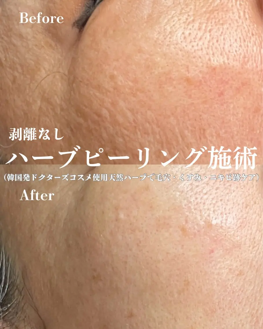 エステ D-Salon プライベートサロンのネイルデザイン