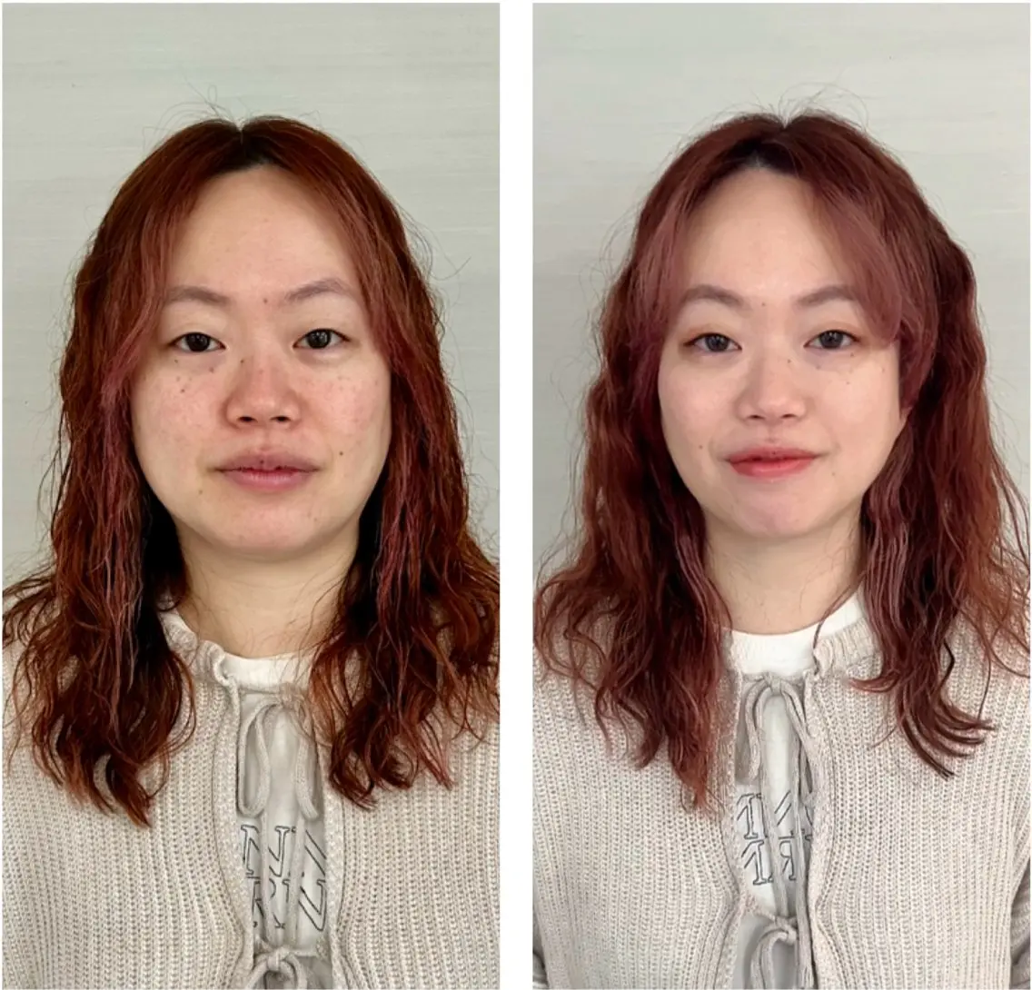 小顔！絶対に変わりたい人の本気の3ヶ月集中スペシャルコースの写真