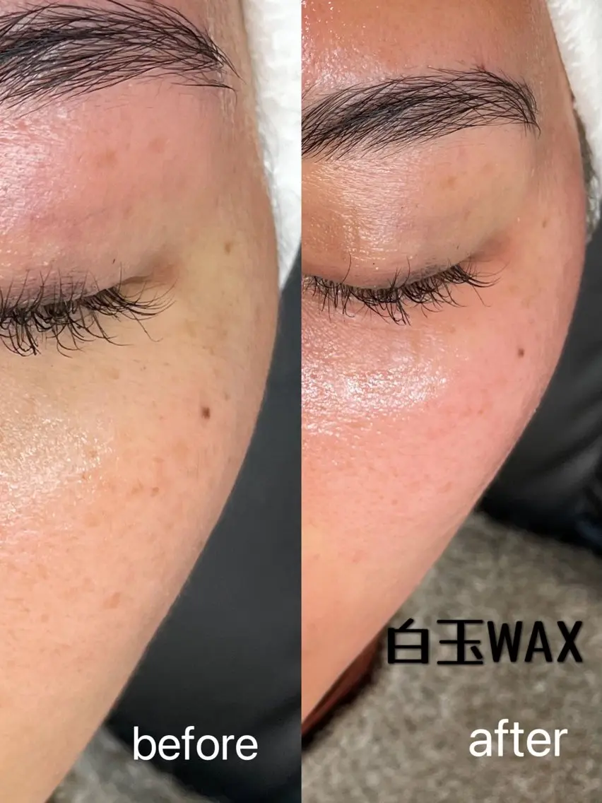 『白玉WAX』天然美容成分100%のスキンケアワックス☺︎産毛・角質・顔ダニを取り除くことで様々なスキンケア効果が！の写真
