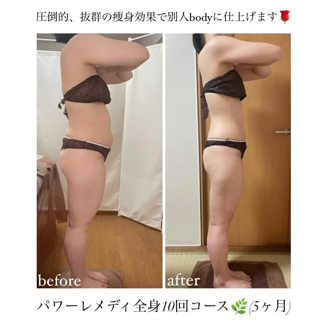 《本気痩せ×疲労改善 》 BILOOPのエステ・リラクイメージ
