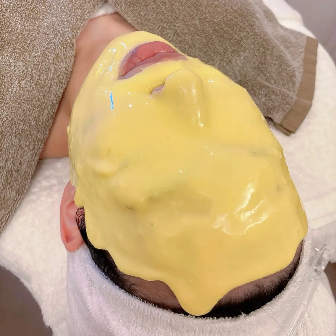 アドバンスコース+ダブルビタQパックの写真