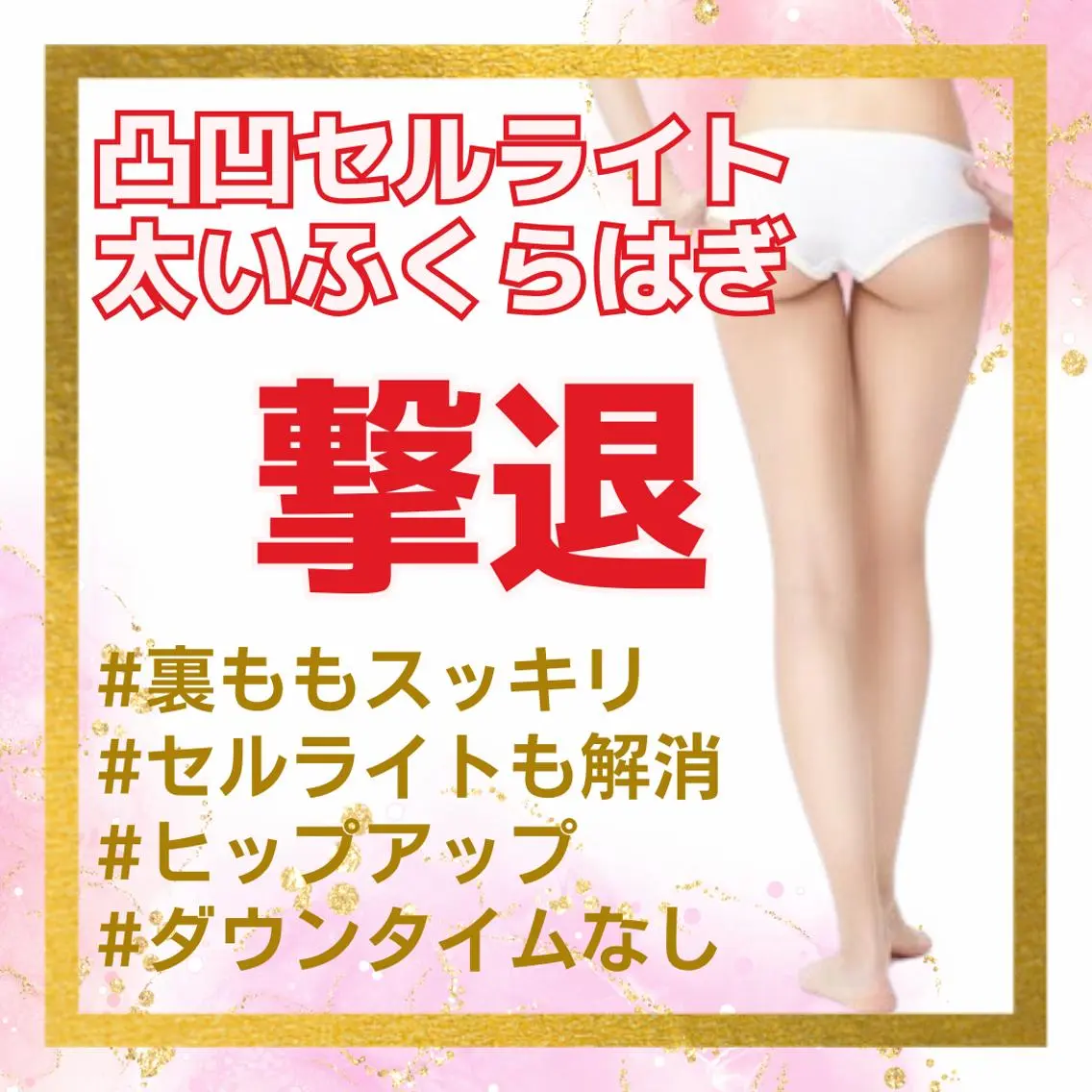 下半身後面】セルライト/太いふくらはぎ☆LD×キャビ×RF×バキューム×EMSの写真