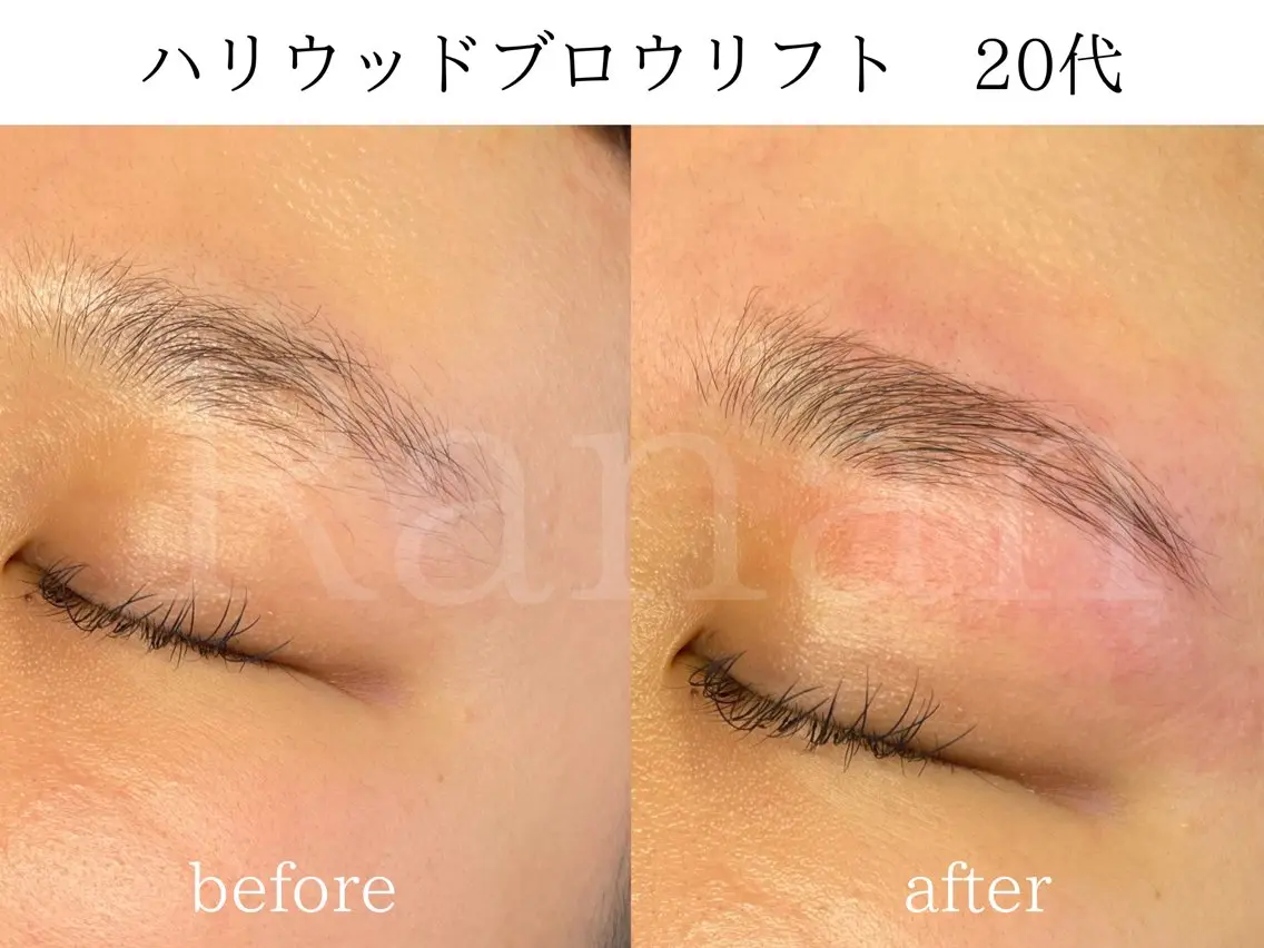 アイブロウ ワックス脱毛 その他(アイブロウ) 韓国肌管理/眉毛専門 Ranan(ラナン)の眉毛・アイブロウイメージ