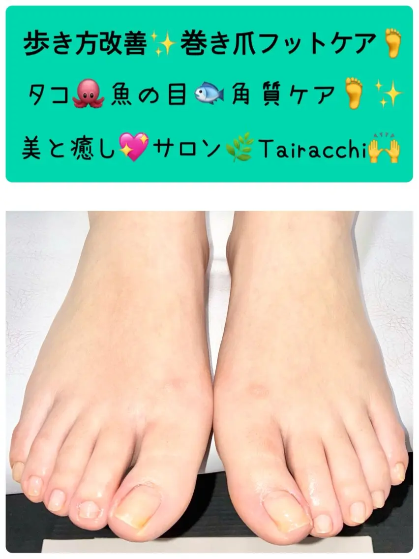 ネイル フットネイル フットネイル Tairacchi タイラッチのエステ・リラクイメージ