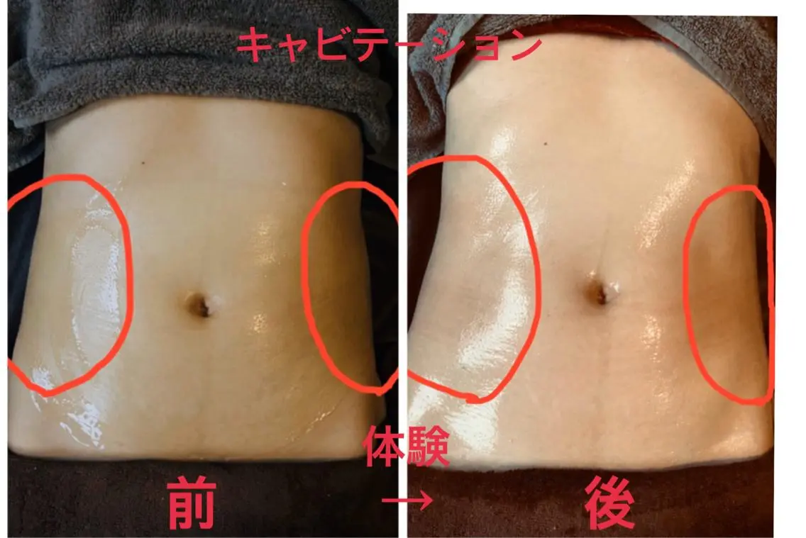 Beauty SalonMireiのエステ・リラクイメージ
