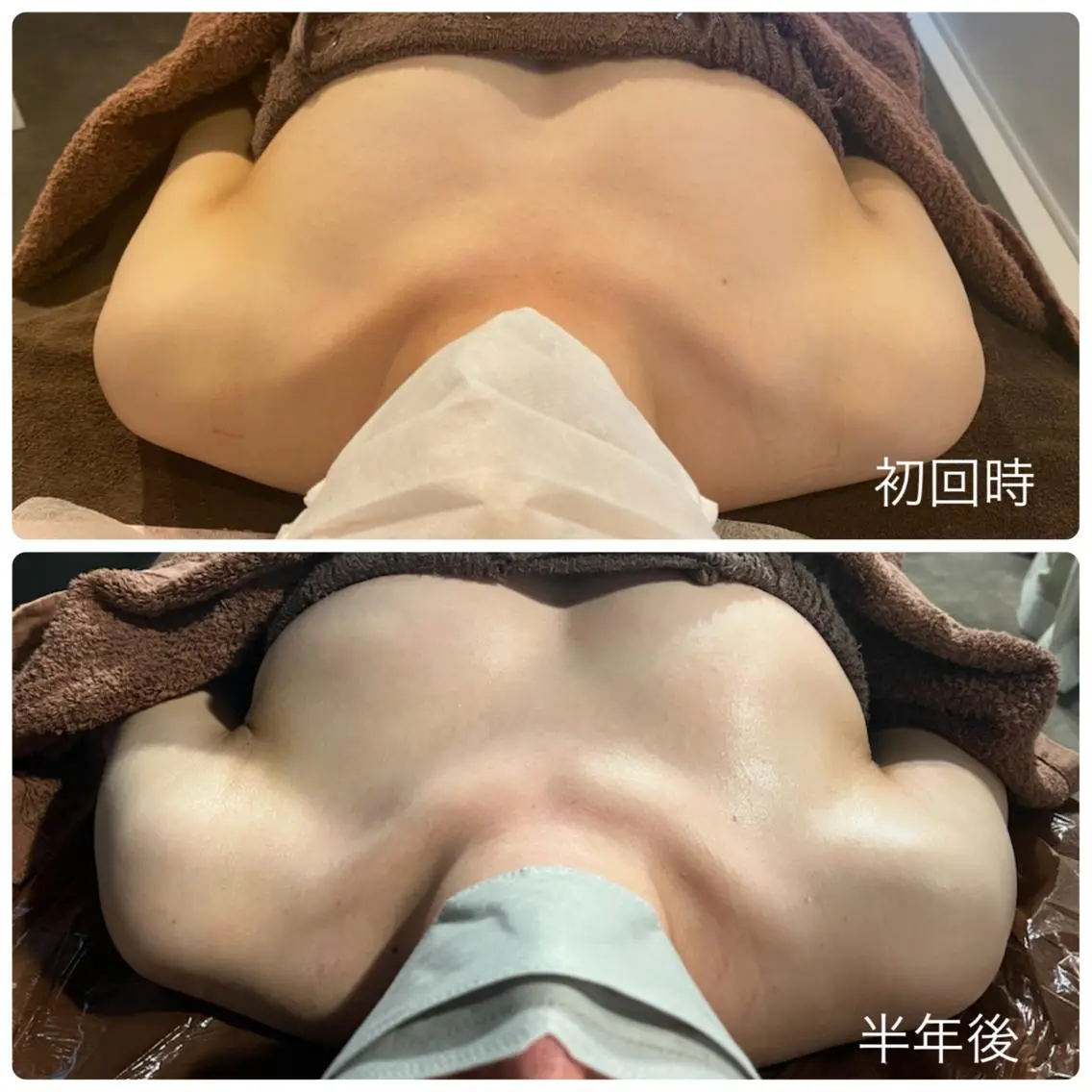 すぐに結果の出る!バストアップ(約60分)バストマッサージ→美容液導入【モニターお写真必須】の写真