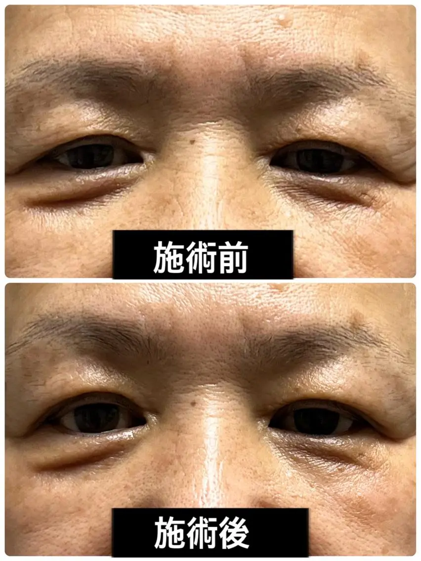 やればやるほど整形超え!プラズマシャワー【リブセラ】フェイシャル トライアルの写真