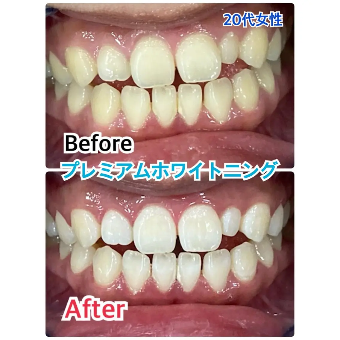【歯科提携】柏ホワイ トニングスタイルのその他イメージ