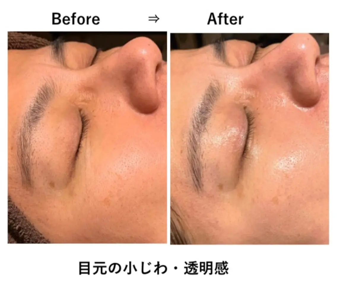 エステ solua Ayamiのマツエク・マツパデザイン